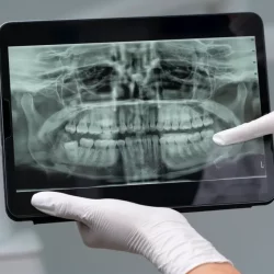 are-dental-x-rays-safe-1024x683