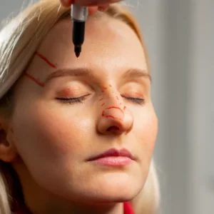 plastic-surgery-clinic-doctor-makes-markings-on-th-2024-12-04-15-11-57-utc-768x512